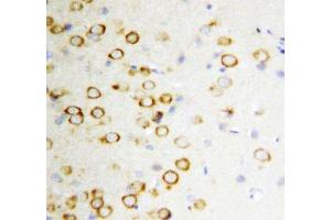 IHC-P: GDNF antibody testing of rat brain tissue (GDNF 抗体  (Middle Region))