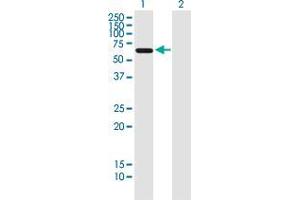 Western Blot analysis of AAAS expression in transfected 293T cell line by AAAS monoclonal antibody (M02), clone 5A1.