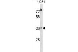 POPD3 Antibody (C-term) (ABIN1881674 and ABIN2838985) western blot analysis in  cell line lysates (35 μg/lane). (POPDC3 抗体  (C-Term))