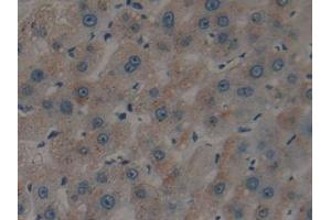 Immunohistochemistry (IHC) image for anti-Plasminogen Activator, Tissue (PLAT) (AA 36-126) antibody (ABIN1860844)