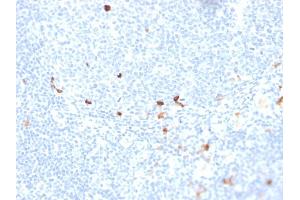 Formalin-fixed, paraffin-embedded human tonsil stained with IgM Recombinant Mouse Monoclonal Antibody (rIGHM/1623). (Recombinant IGHM 抗体)