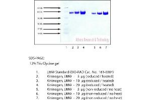 Gel Scan of Kininogen, LMW, Human Plasma  This information is representative of the product ART prepares, but is not lot specific. (LMW Kininogen 蛋白)
