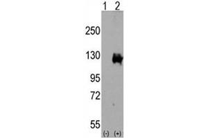 Western blot analysis of TRPM8 antibody and 293 cell lysate either nontransfected (Lane 1) or transiently transfected with the TRPM8 gene (2). (TRPM8 抗体  (AA 1075-1104))