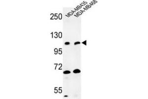 Western Blotting (WB) image for anti-Exostoses (Multiple)-Like 3 (EXTL3) antibody (ABIN3004013) (EXTL3 抗体)