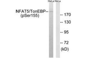 Western blot analysis of extracts from HeLa cells treated with forskolin 40nM 30', using NFAT5/TonEBP (Phospho-Ser155) Antibody. (NFAT5 抗体  (pSer155))