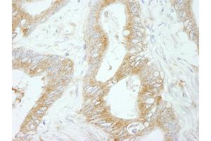 Immunohistochemistry (IHC) image for anti-Flightless I Homolog (FLII) (AA 425-475) antibody (ABIN7448968) (FLII 抗体  (AA 425-475))
