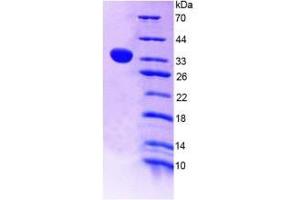 SDS-PAGE (SDS) image for Angiopoietin-Like 4 (ANGPTL4) ELISA Kit (ABIN6720566)