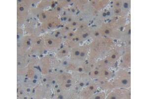 IHC-P analysis of liver tissue, with DAB staining. (PANK1 抗体  (AA 298-500))