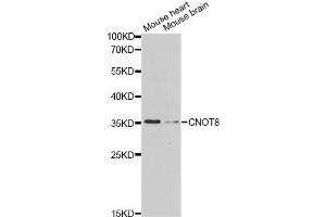 Western blot analysis of extracts of various cell lines, using CNOT8 Antibody. (CNOT8 抗体)