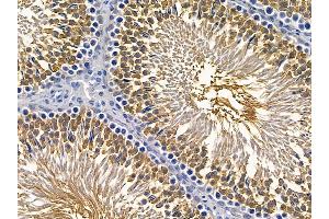 ABIN6257498 and ABIN6275600 at 1/100 staining rat testis tissue by IHC-P. (Sorting Nexin 1 抗体  (Internal Region))