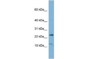 Western Blotting (WB) image for anti-Protein Phosphatase 1, Regulatory (Inhibitor) Subunit 11 (PPP1R11) (N-Term) antibody (ABIN2783353)