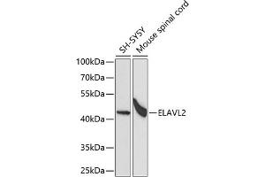 Western blot analysis of extracts of various cell lines, using EL antibody (ABIN6134649, ABIN6140114, ABIN6140116 and ABIN6221621) at 1:1000 dilution. (ELAVL2 抗体  (AA 1-100))