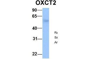 Host:  Rabbit  Target Name:  OXCT2  Sample Type:  Human Fetal Lung  Antibody Dilution:  1. (OXCT2 抗体  (Middle Region))