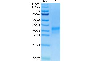SDS-PAGE (SDS) image for Receptor tyrosine-protein kinase erbB-2 (ErbB2/Her2) (AA 489-630) protein (His-Avi Tag,Biotin) (ABIN7274804)