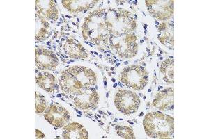 Immunohistochemistry of paraffin-embedded human stomach using CTSC antibody. (CTSC 抗体  (AA 25-134))