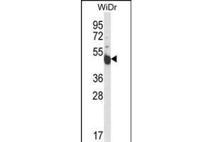 Western blot analysis of INSC Antibody (Center) (ABIN653657 and ABIN2842997) in WiDr cell line lysates (35 μg/lane). (INSC 抗体  (AA 410-437))