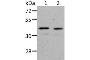 Western Blot analysis of Jurkat cell and Human fetal kidney tissue using NIF3L1 Polyclonal Antibody at dilution of 1:500 (NIF3L1 抗体)