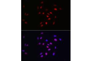 Immunofluorescence analysis of U2OS cells using HDGF Rabbit mAb (ABIN7267622) at dilution of 1:100 (40x lens). (HDGF 抗体)