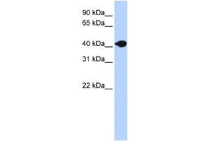 WB Suggested Anti-DNASE2B Antibody Titration:  0. (DNASE2B 抗体  (N-Term))