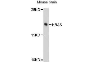 Western blot analysis of extracts of mouse brain, using HRAS Antibody. (HRAS 抗体  (AA 1-189))