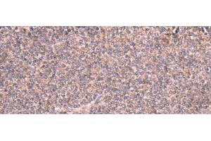 Immunohistochemistry of paraffin-embedded Human tonsil tissue using MRPS24 Polyclonal Antibody at dilution of 1:90(x200) (MRPS24 抗体)