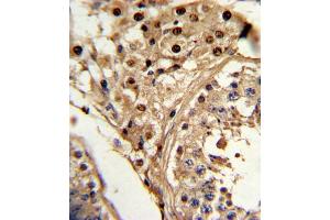 Immunohistochemistry (IHC) image for anti-Kruppel-Like Factor 6 (KLF6) antibody (ABIN3002701) (KLF6 抗体)