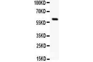 Anti-SSTR1 antibody, Western blotting All lanes: Anti SSTR1  at 0. (SSTR1 抗体  (C-Term))