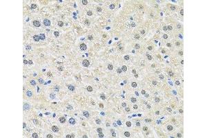 Immunohistochemistry (Paraffin-embedded Sections) (IHC (p)) image for anti-Solute Carrier Family 3 (Activators of Dibasic and Neutral Amino Acid Transport), Member 2 (SLC3A2) antibody (ABIN7010781)