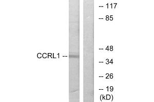 Western blot analysis of extracts from 293 cells, using CCRL1 antibody. (CCRL1 抗体  (N-Term))