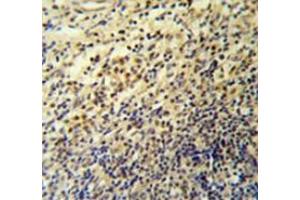 Immunohistochemistry analysis in tonsil (Formalin-fixed, Paraffin-embedded) using PLA2G7 Antibody , followed by peroxidase conjugated secondary antibody and DAB staining. (PLA2G7 抗体  (Middle Region))