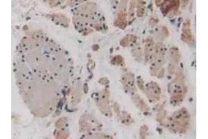 Immunohistochemistry (IHC) image for anti-Forkhead Box O1 (FOXO1) (AA 333-557) antibody (ABIN7432556)
