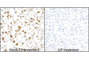 Immunohistochemistry (IHC) image for anti-Minichromosome Maintenance Complex Component 2 (MCM2) (pSer53) antibody (ABIN7449430) (Recombinant MCM2 抗体  (pSer53))