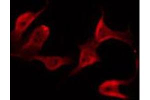 ABIN6272383 staining Hela by IF/ICC. (PDE4B/C/D 抗体)