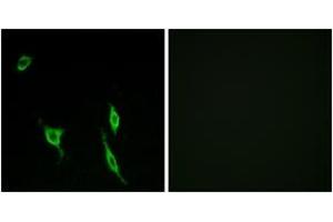 Immunofluorescence analysis of LOVO cells, using DCC Antibody. (DCC 抗体  (AA 441-490))