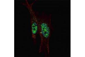 Immunofluorescence (IF) image for anti-Signal Transducer and Activator of Transcription 3 (Acute-Phase Response Factor) (STAT3) (AA 711-743) antibody (ABIN3032569)