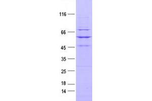 Validation with Western Blot