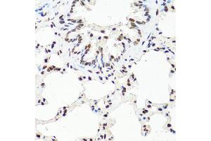 Immunohistochemistry of paraffin-embedded rat lung using TET2 antibody at dilution of 1:100 (40x lens). (TET2 抗体)