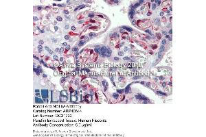 Immunohistochemistry (IHC) image for anti-NOP56 Ribonucleoprotein Homolog (NOP56) (Middle Region) antibody (ABIN2778982) (NOP56 抗体  (Middle Region))