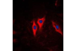 Immunofluorescent analysis of Cytokeratin 5 staining in HeLa cells. (Cytokeratin 5 抗体  (C-Term))