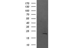 Image no. 1 for anti-NFKB Inhibitor Interacting Ras-Like 1 (NKIRAS1) antibody (ABIN1499741) (NKIRAS1 抗体)