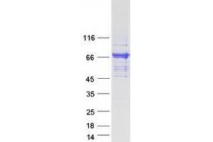 Western Blotting (WB) image for Calcium/calmodulin-Dependent Protein Kinase Kinase 2, beta (CAMKK2) (Transcript Variant 2) protein (Myc-DYKDDDDK Tag) (ABIN2713100)