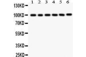Anti- STIM1 Picoband antibody, Western blotting All lanes: Anti STIM1  at 0. (STIM1 抗体  (N-Term))