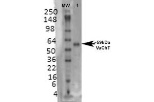 Western Blot analysis of Rat brain membrane lysate showing detection of VAChT protein using Mouse Anti-VAChT Monoclonal Antibody, Clone S6-38 . (SLC18A3 抗体  (AA 521-532) (FITC))