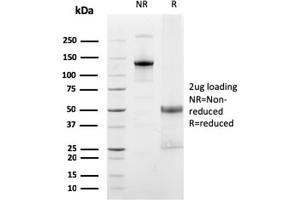 SDS-PAGE Analysis Purified FCGRT Mouse Monoclonal Antibody (FCGRT/2932). (FcRn 抗体  (AA 24-215))