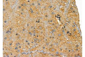 ABIN6259272 and ABIN6276054 at 1/100 staining Rat brain tissue by IHC-P.