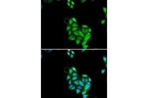 Immunofluorescence analysis of U2OS cells using JADE1 antibody (ABIN5973751). (PHF17 抗体)
