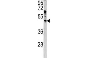 Western blot analysis of ANGPTL7 antibody and HeLa lysate. (ANGPTL7 抗体  (AA 74-104))