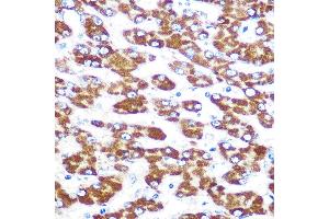 Immunohistochemistry of paraffin-embedded human liver using IDO1 Rabbit mAb (ABIN7267863) at dilution of 1:100 (40x lens). (IDO1 抗体)