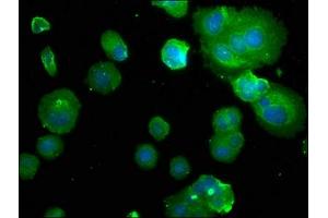 Immunofluorescence staining of MCF-7 with ABIN7146416 at 1:50, counter-stained with DAPI. (PDE1B 抗体  (AA 1-277))