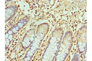 Immunohistochemistry of paraffin-embedded human small intestine tissue using ABIN7172071 at dilution of 1:100 (TREX1 抗体  (AA 1-270))